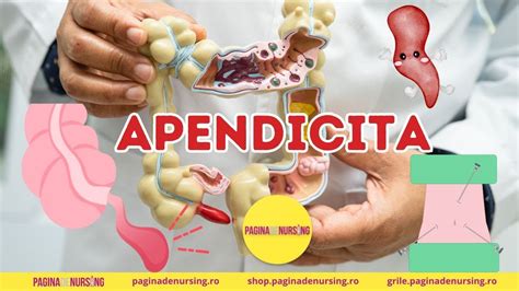 apendicita acuta|Apendicita (îngrijirea pacientului cu apendicită